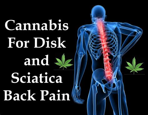 Is Cannabis Effective in Pain Relief or Is It Placebo?