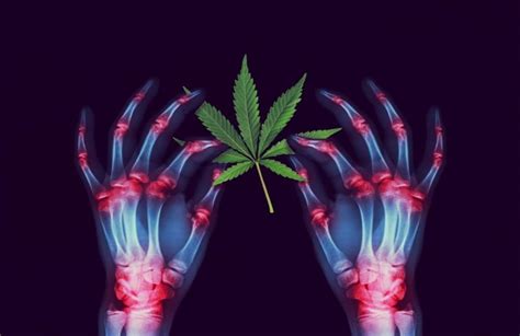 Is Cannabis an Effective Remedy for Pain Relief?
