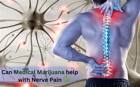 Is Cannabis Effective in Treating Nerve Pain?